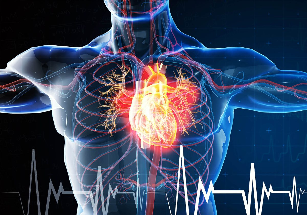 Research finds that heart attacks could be an infectious disease.