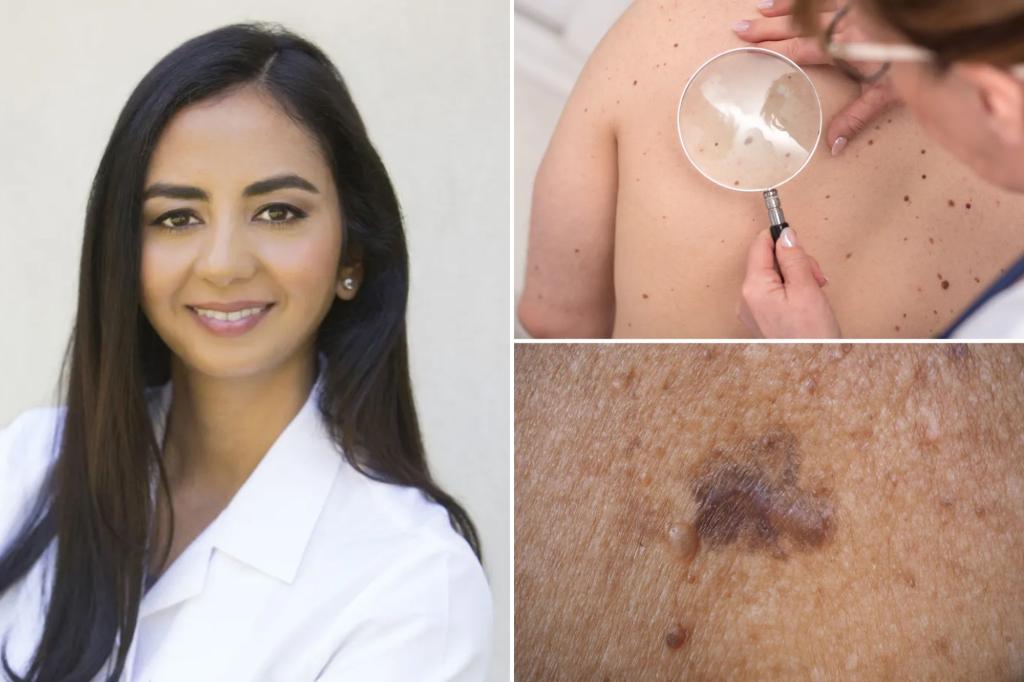 Signs of skin cancer — 9 warning indicators to pay attention to
