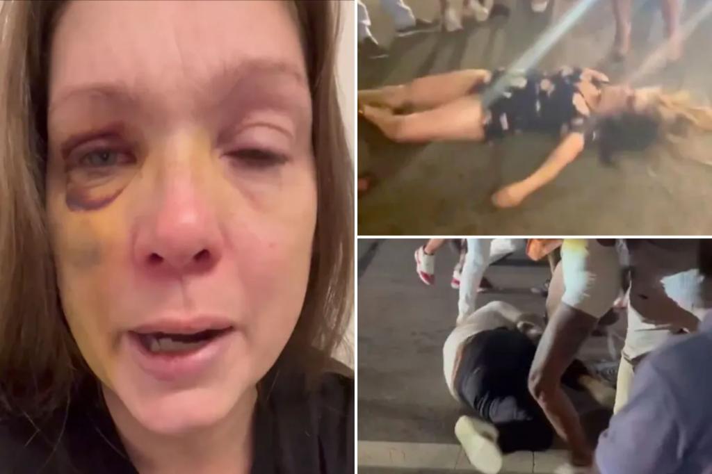 Single mother brutally knocked unconscious in Cincinnati mob assault speaks out: 'Still healing'
