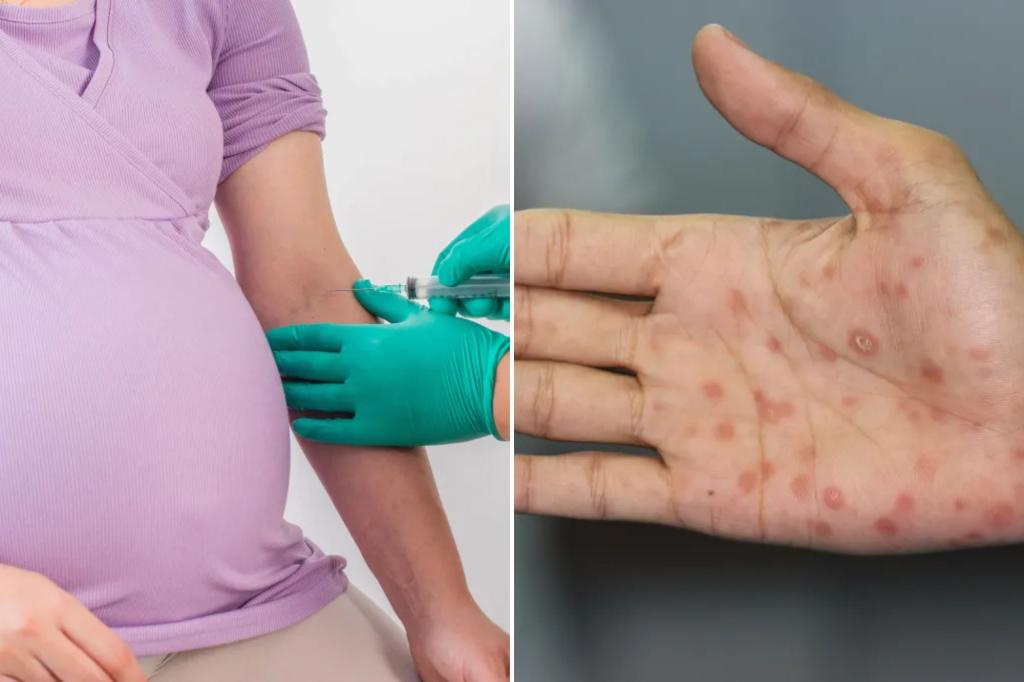 Three infants pass away during worrying increase of syphilis in New York