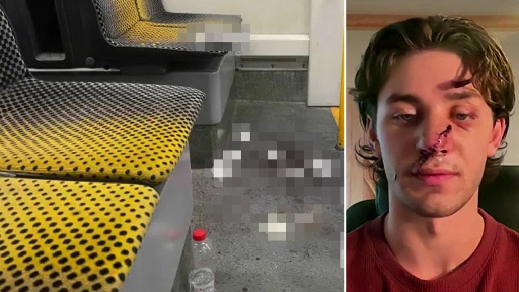 Tourist attacked while defending women criticizes Europe's immigration problem