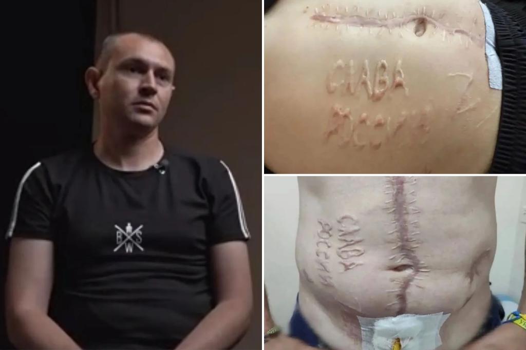 Ukrainian prisoner of war marked with 'Glory to Russia' promises to fight again