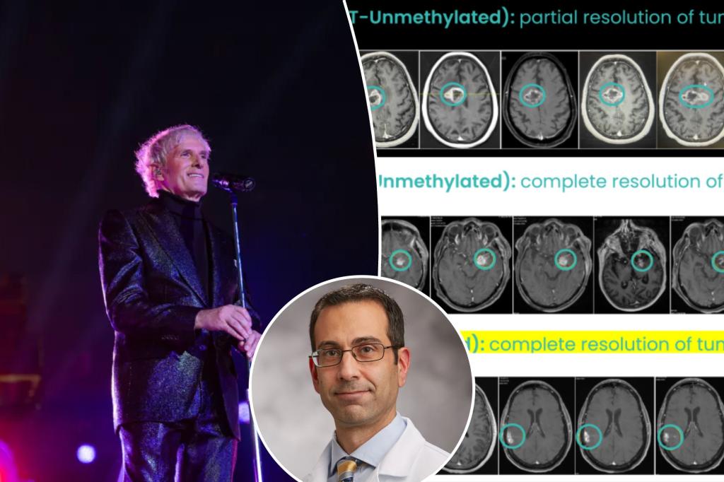 Understanding glioblastoma: Michael Bolton's cancer and 5 symptoms to be aware of