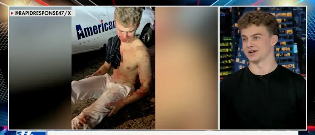 A Broken Nose and a Concussion: DOGE's 'Big Balls' Tells of Intense Attack to Protect a Friend