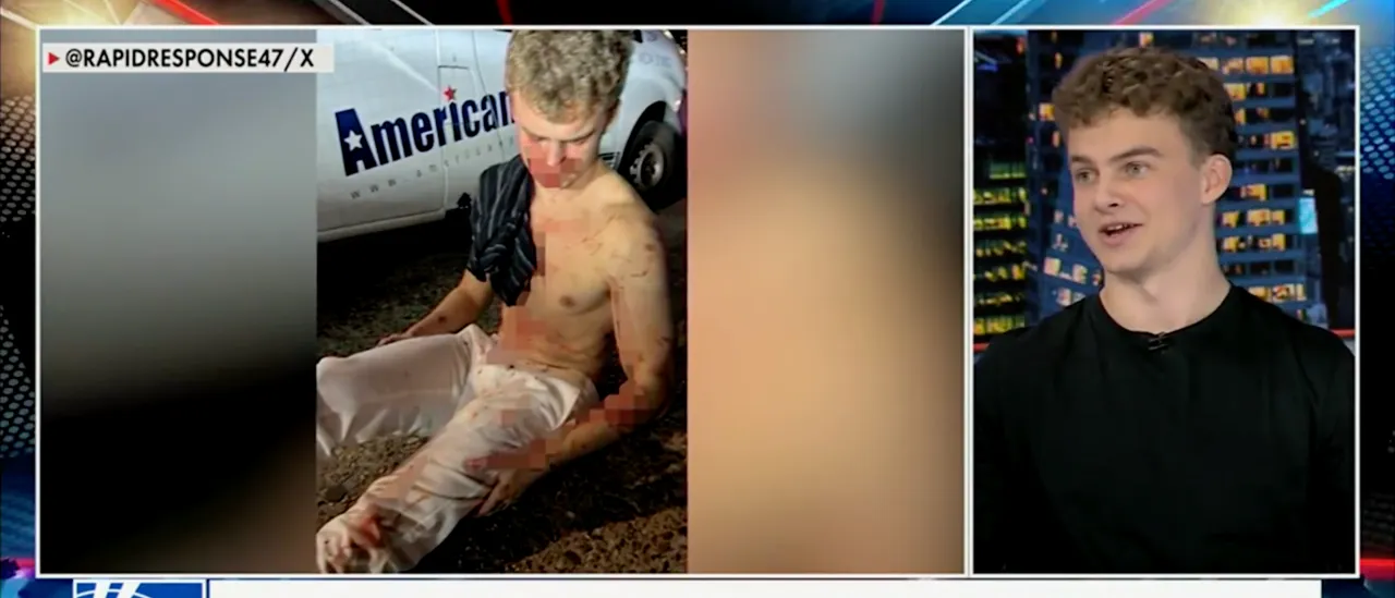 A Broken Nose and a Concussion: DOGE's 'Big Balls' Tells of Intense Attack to Protect a Friend