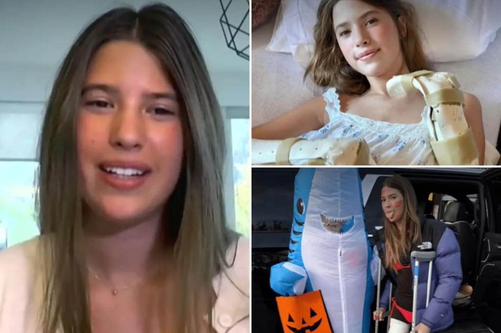 Annabelle Carlson shares her experience of a shark attack in Belize