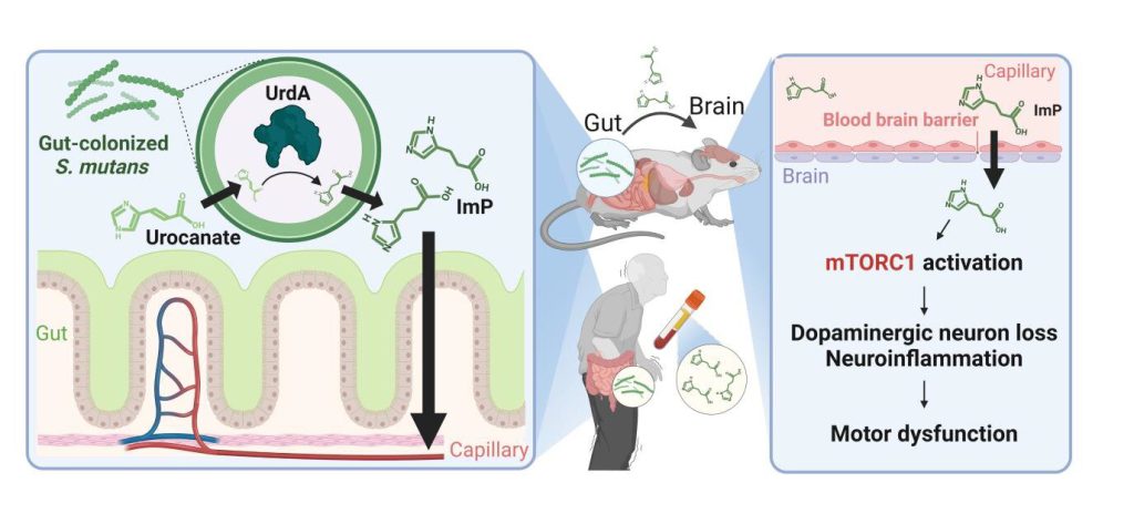 Bacteria in the mouth connected to Parkinson's through the gut-brain connection