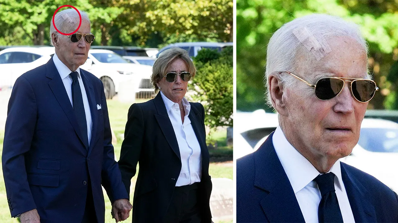 Biden spotted with a large scar on his head following skin cancer surgery