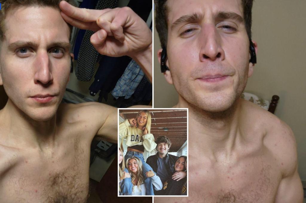Bryan Kohberger shared shirtless selfies showing a hand injury following the murders of University of Idaho students.