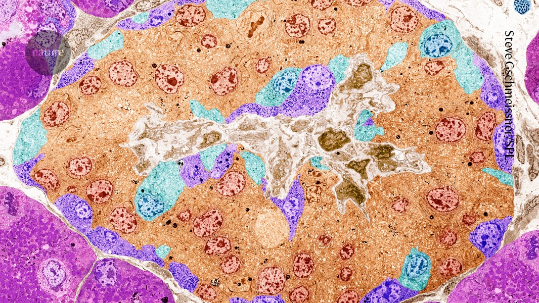 Cells edited with CRISPR produce insulin in an individual while avoiding detection by the immune system.