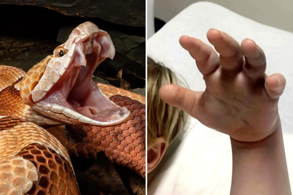 Child bitten by snake at day care but staff did not contact emergency services: reports