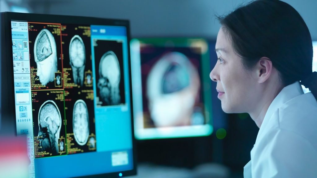 Diagnostic software increases the rate of complete recovery in stroke patients threefold.