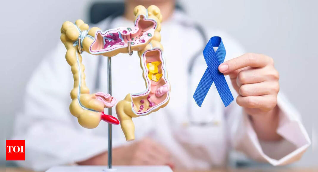 Doctor discusses five crucial lessons about colon cancer: Important symptoms and risks to be aware of