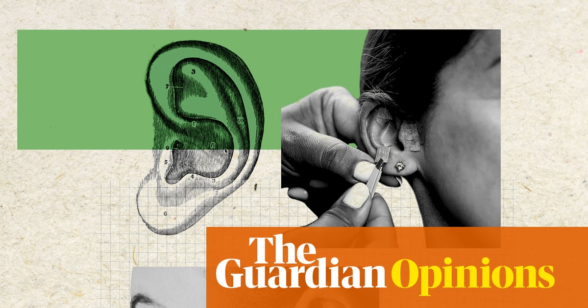 Ear seeding: does this traditional wellness method actually reduce facial puffiness?