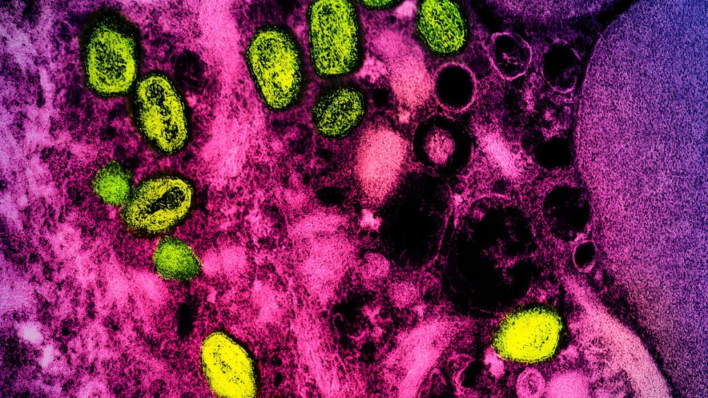 Feds Raise Concerns by Bringing Back the Name 'Monkeypox' After Dropping It in 2022