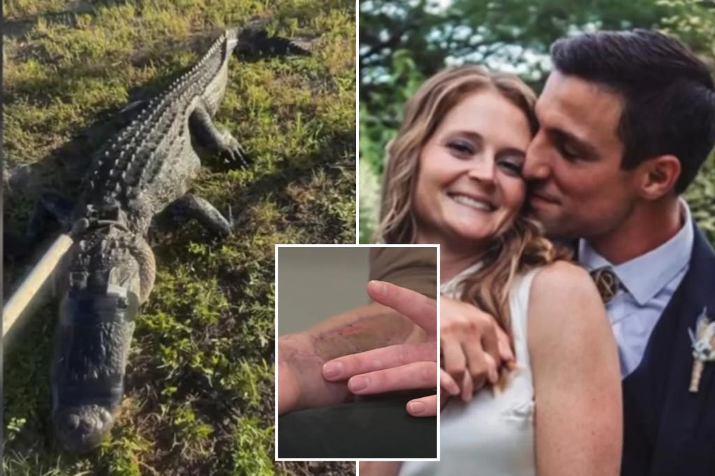 Florida physician attacked by 8-foot alligator in a terrifying struggle