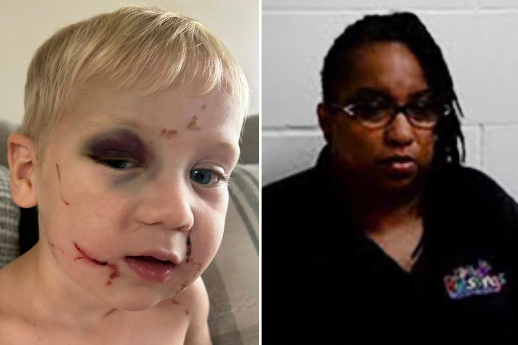 Georgia day care employee accused of hitting 1-year-old granted bail