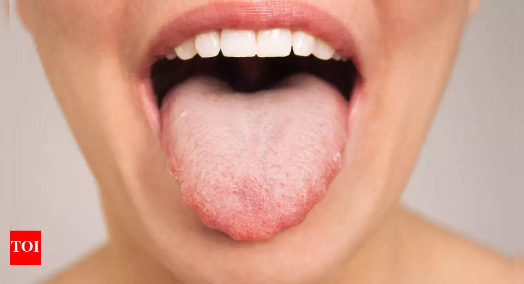 Heart Health: How your tongue reflects your heart health