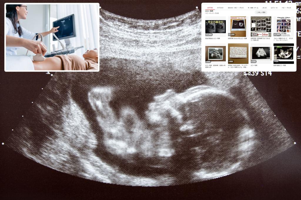 Japanese app prohibits the sale of ultrasound images due to concerns over pregnancy scams