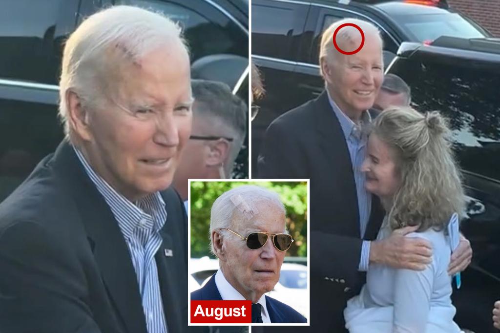 Joe Biden, 82, observed with a serious head injury as his appearance raises worries