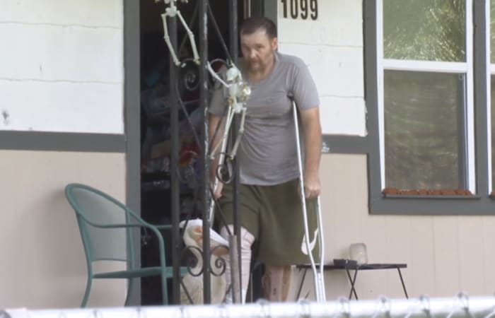 Local man with a flesh-eating infection says he was released due to lack of insurance. Here’s the hospital's response.