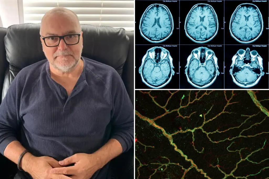 Man's HR meeting uncovers diagnosis of frontal lobe dementia