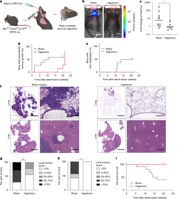 Mechanisms of small cell lung cancer development influenced by neuronal activity