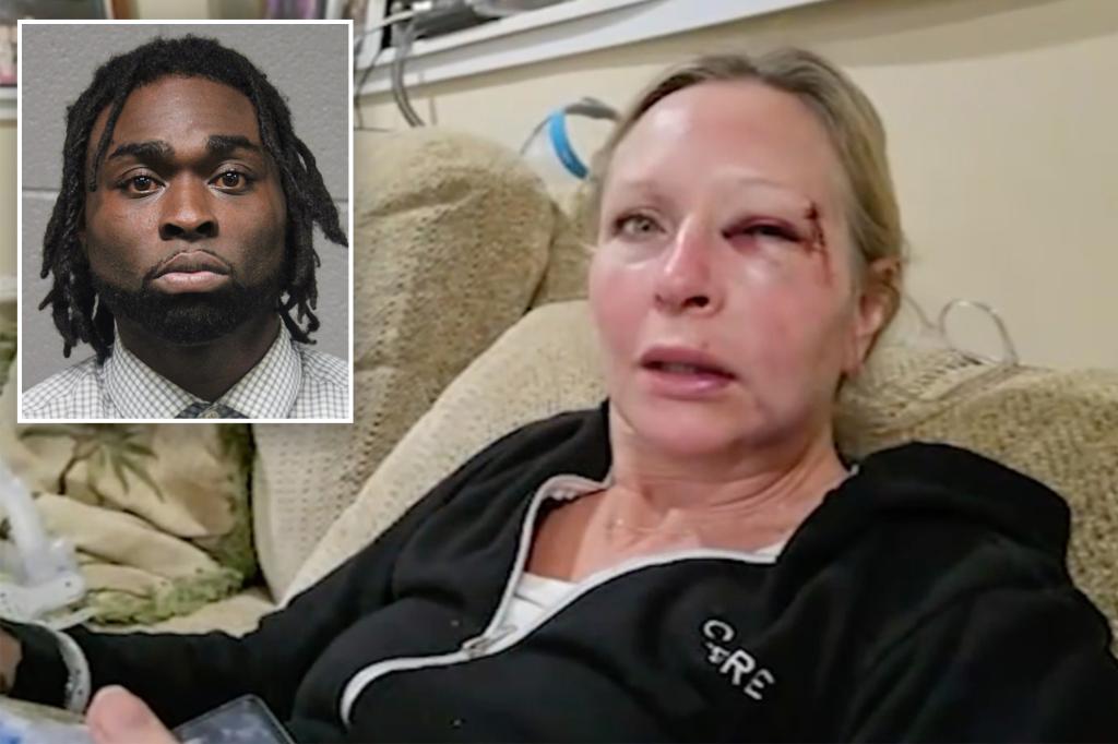 Mom from Chicago, Kathleen Miles, attacked by repeat offender William Livingston in Downtown incident.