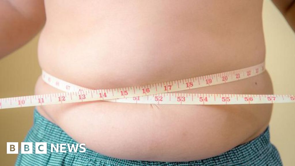 More children are obese than are underweight, a warning from Unicef