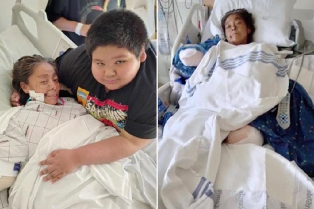 Oklahoma woman has both arms and legs amputated following severe dog attack