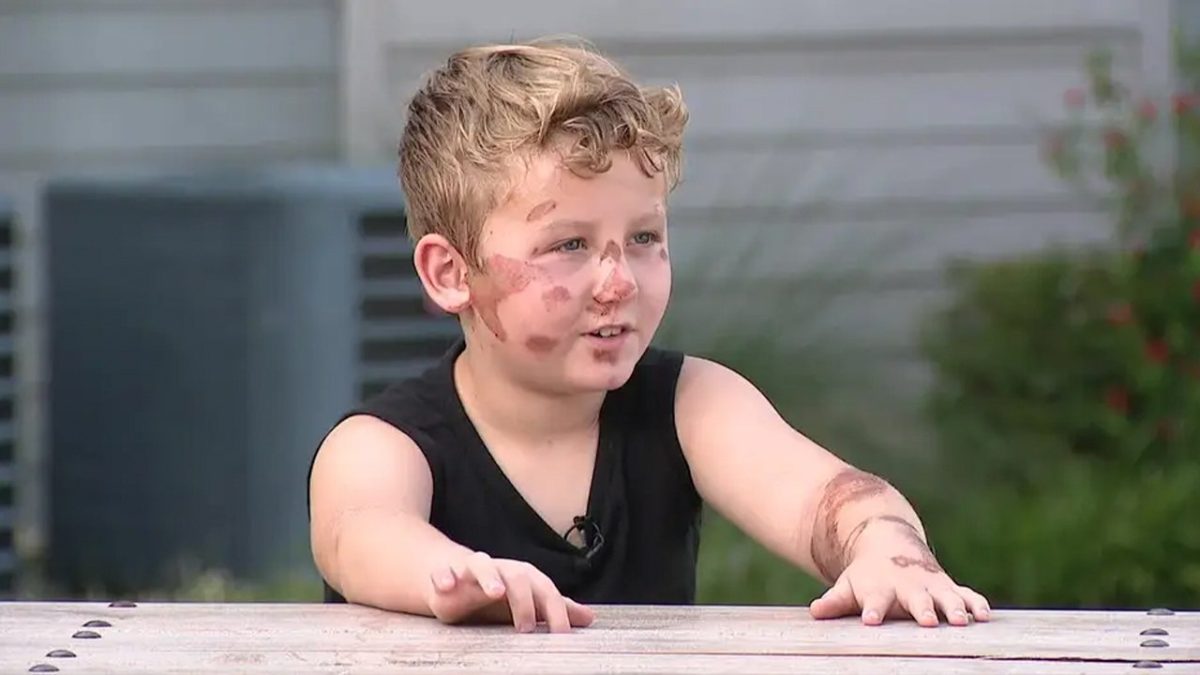 Police in Fort Worth, TX, seek the driver who hit an 8-year-old boy and fled the scene