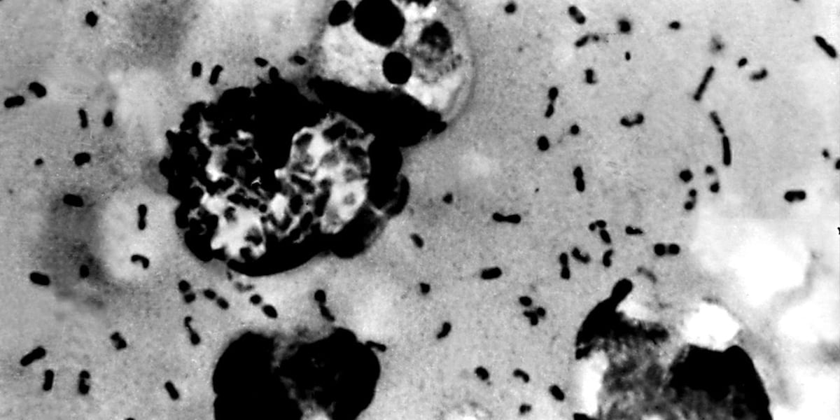 Possible plague in southern Colorado county after large die-off of prairie dogs