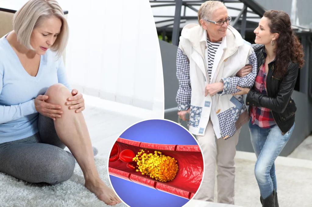 Quiet illness may pose a hidden threat to your legs