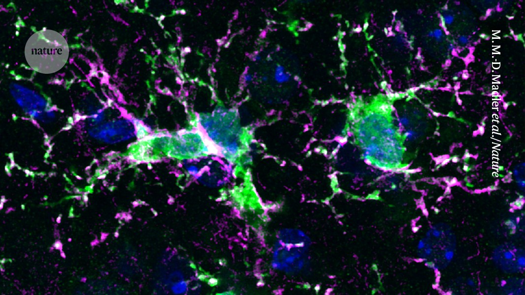 Replacing aging immune cells in the brain with new ones may help in treating illness
