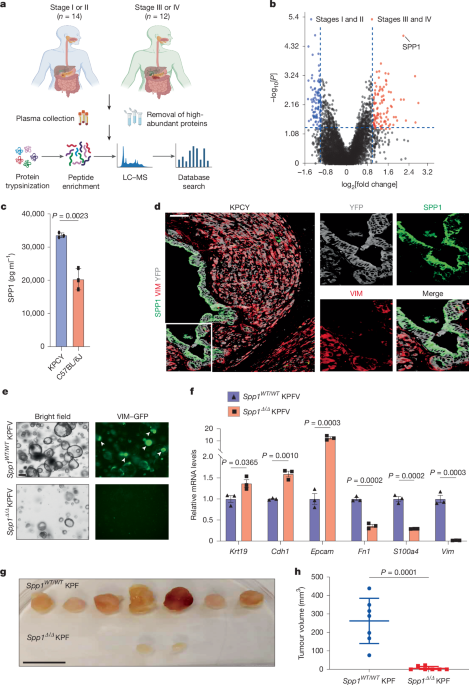SPP1 is necessary for preserving mesenchymal cell identity in pancreatic cancer