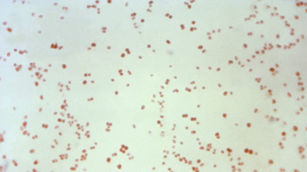 STD trends: Overall cases decline, but syphilis in newborns increases again