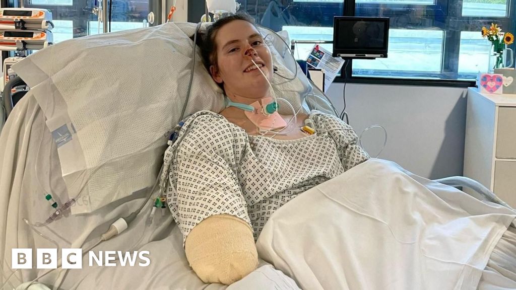 Sepsis causes Cardiff medical student to confront life without limbs