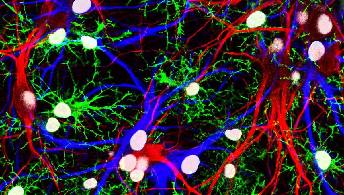 This Protein Triggers Brain Aging, and Researchers Have Discovered How to Halt It