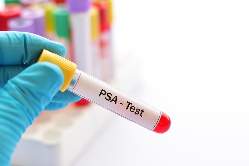 This type of cancer usually shows no warning signs &mdash; an innovative new treatment freezes it away