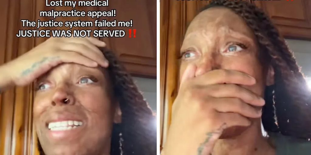 Woman whose skin was severely damaged due to a medication mistake cries out in pain after being denied justice by the courts