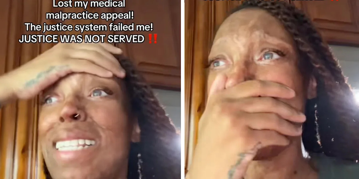 Woman whose skin was severely damaged due to a medication mistake cries out in pain after being denied justice by the courts