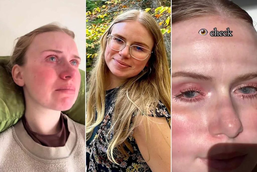 26-Year-Old Shares Emotional Journey of Losing Her Vision as Her Corneas 'Died': 'I Feel Helpless'
