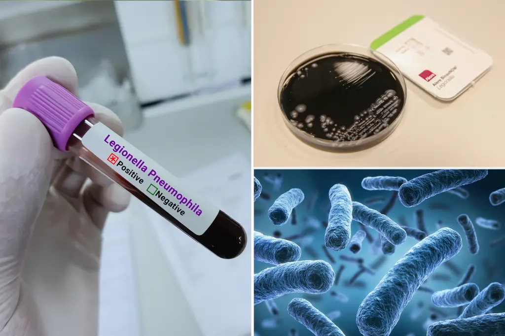 Council regulation enhances testing for Legionnaires' disease in cooling towers