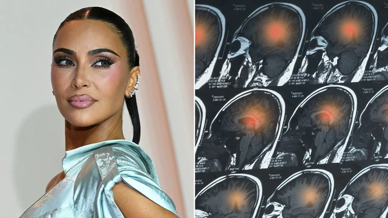 Doctors raise concerns following Kim Kardashian’s announcement about her brain aneurysm.