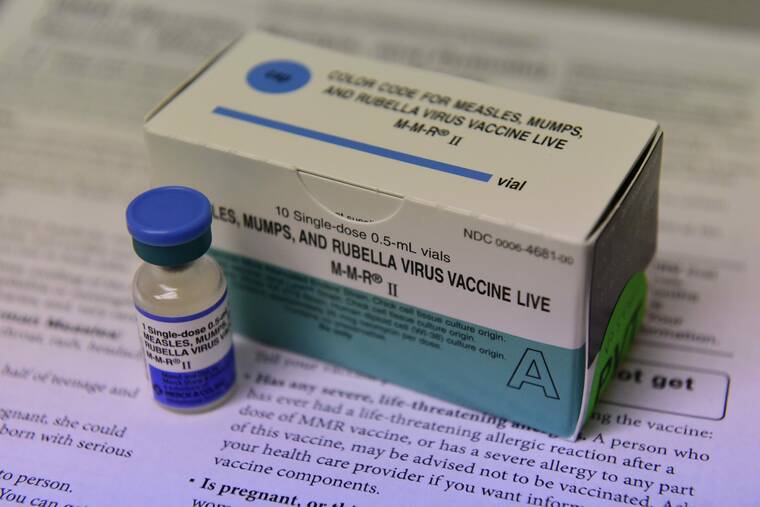 Health officials verify case of mumps acquired in the community on Hawaii island