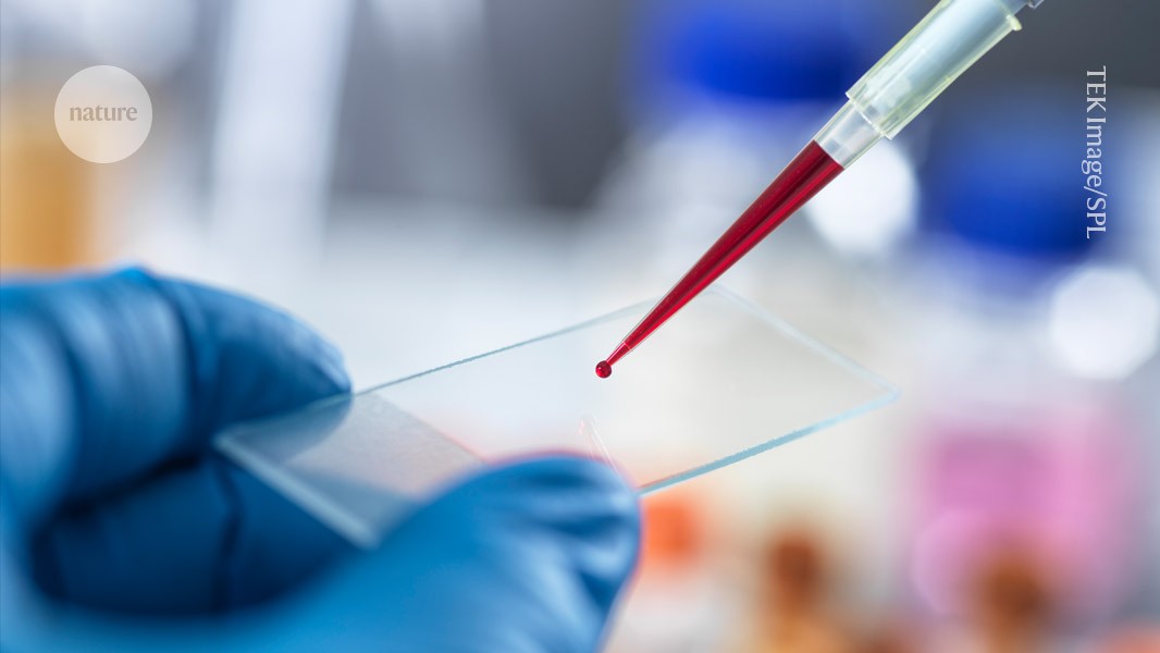 Initial suggested blood test for chronic fatigue syndrome: scientists' opinions