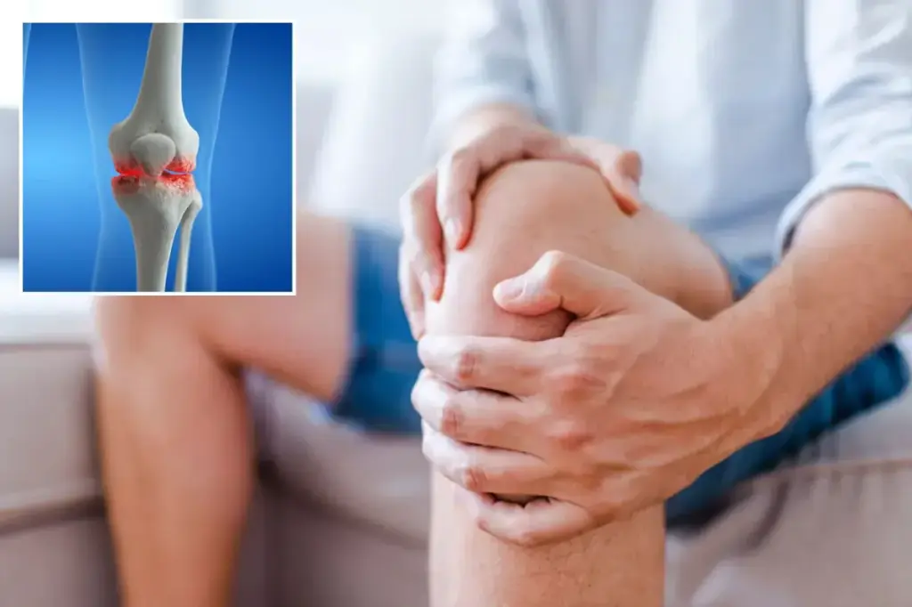 Low-dose radiation may lessen knee arthritis, study finds