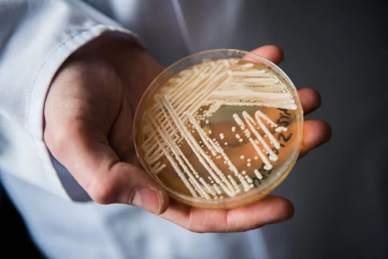New research identifies 7 risk factors for deadly fungus infections caused by Candida auris
