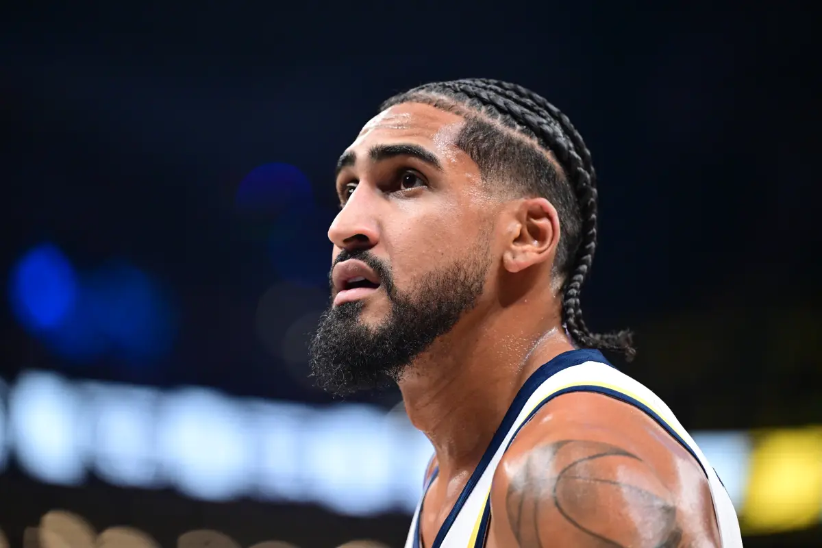 Obi Toppin of the Pacers requires surgery that will keep him out until February.