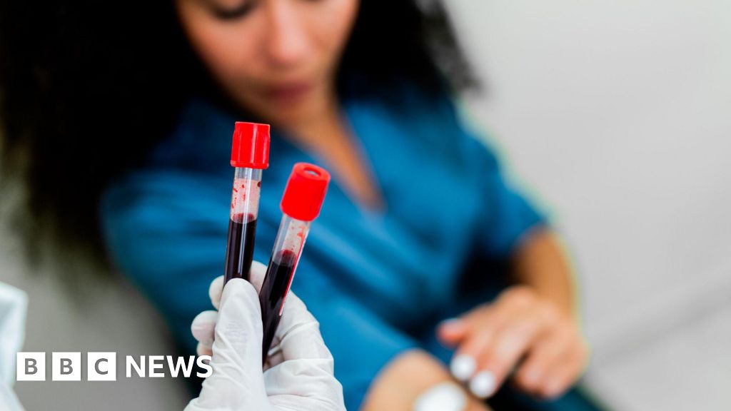 Promising findings from blood test for 50 types of cancer